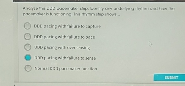 Solved Analyze this DDD pacemaker strip. Identify any | Chegg.com