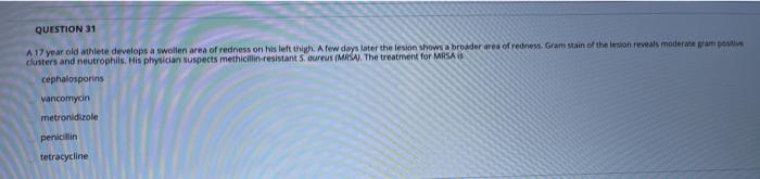 Solved fecalararo person to person contad QUESTION 44 A 35 | Chegg.com