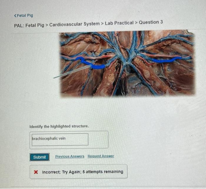 Solved Cardiovascular System > Lab Practical > Question 3