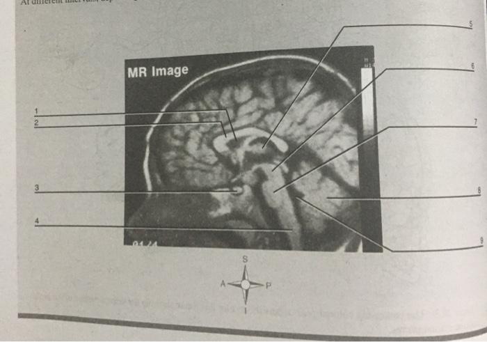 Solved TABLE 20.1 Cranial Nerves Cranial Nerve General | Chegg.com