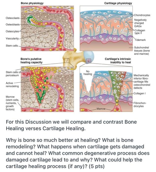 Solved Bone physiology Cartilage physiology Chondrocytes | Chegg.com