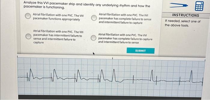 [Solved]: Analyze this ( mathrm{VVI} ) pacemaker stri