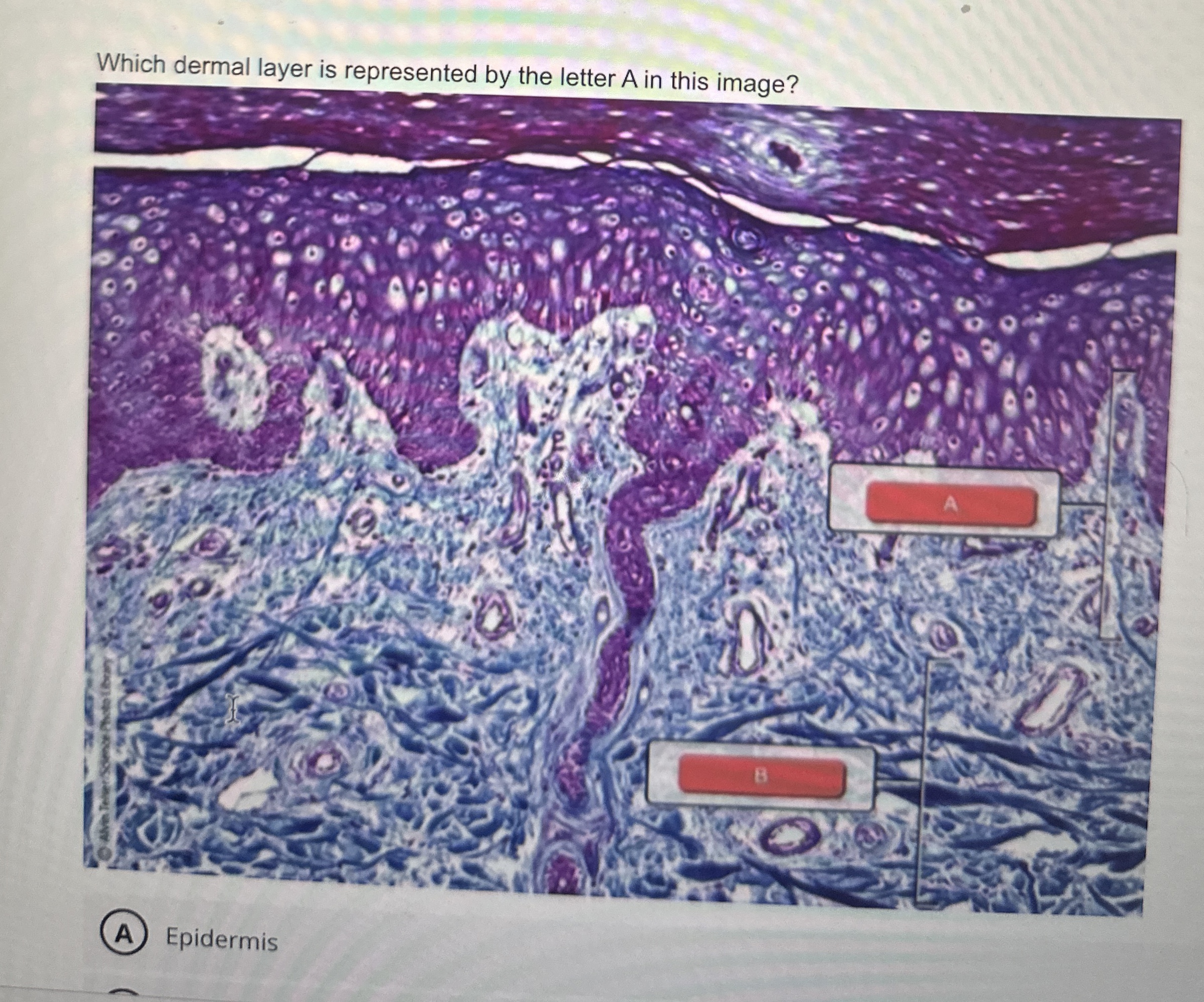 Solved Hat Which dermal layer is represented by the letter A | Chegg.com