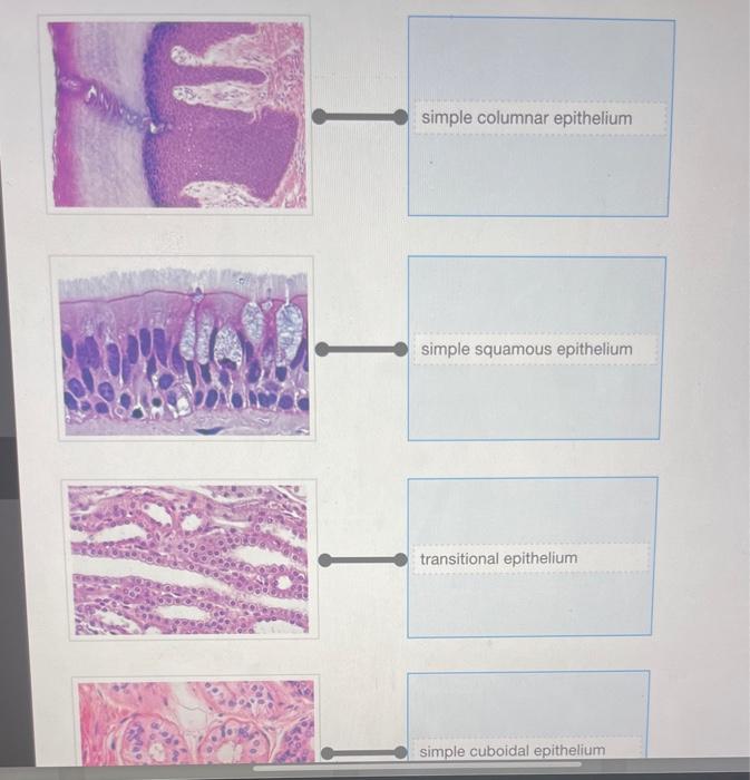 Solved TE simple columnar epithelium simple squamous | Chegg.com