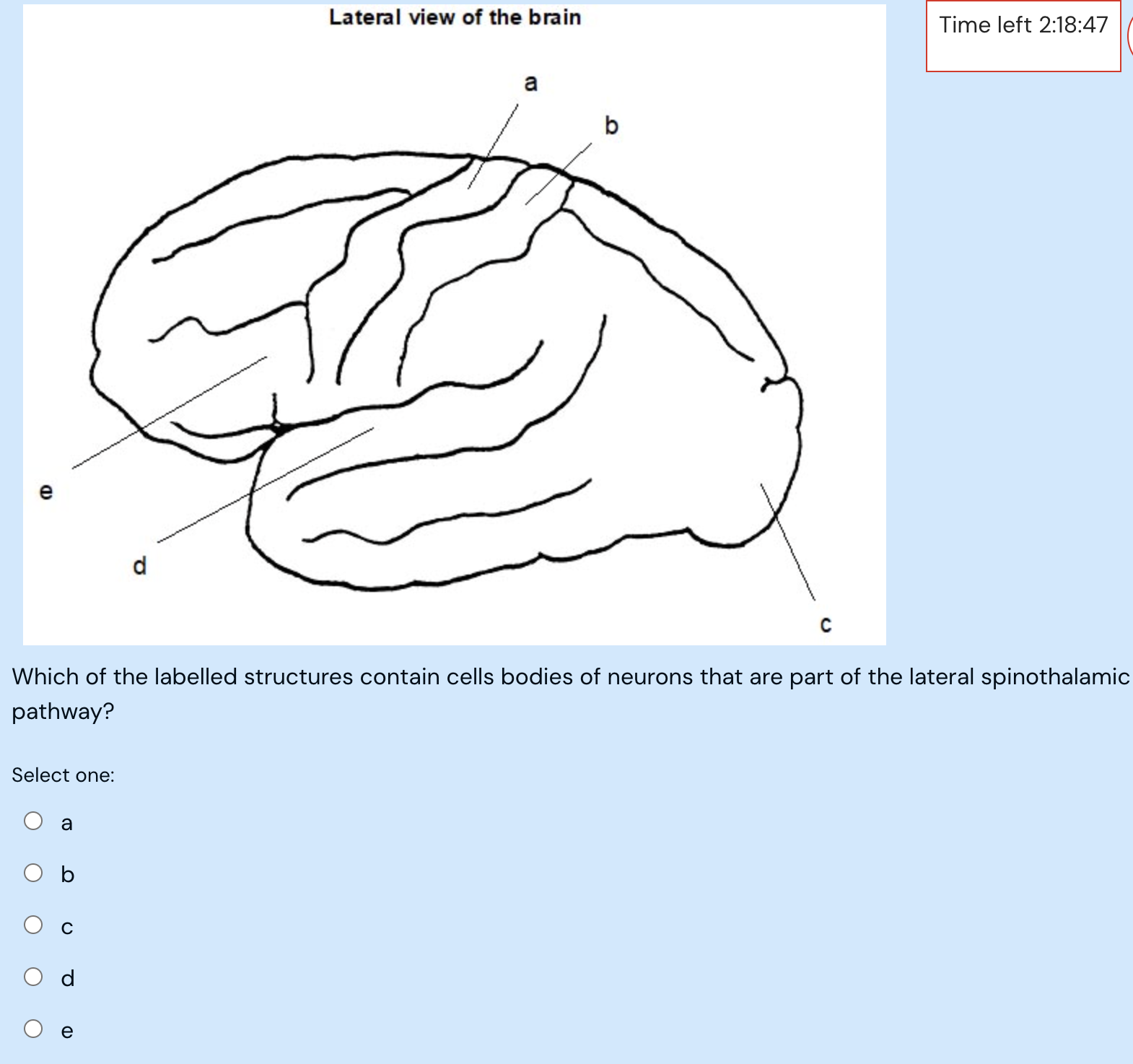 Solved Which of the labelled structures contain cells bodies | Chegg.com