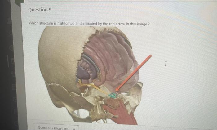 Which Structure Is Highlighted And Indicated By The Red Arrow In This Image