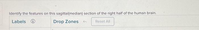 Solved Identify The Features On This Sagittal (median) | Chegg.com