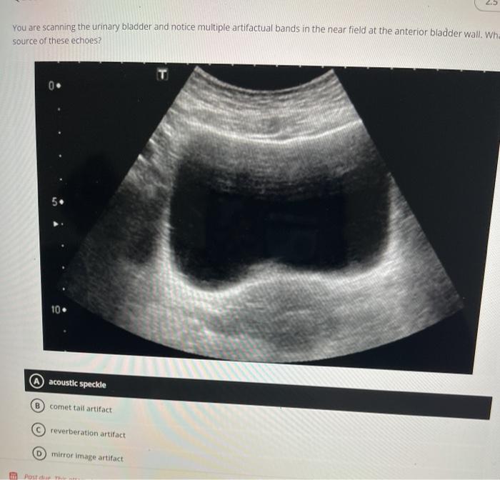 Solved Question 34 2 Describe the sonographic findings in | Chegg.com