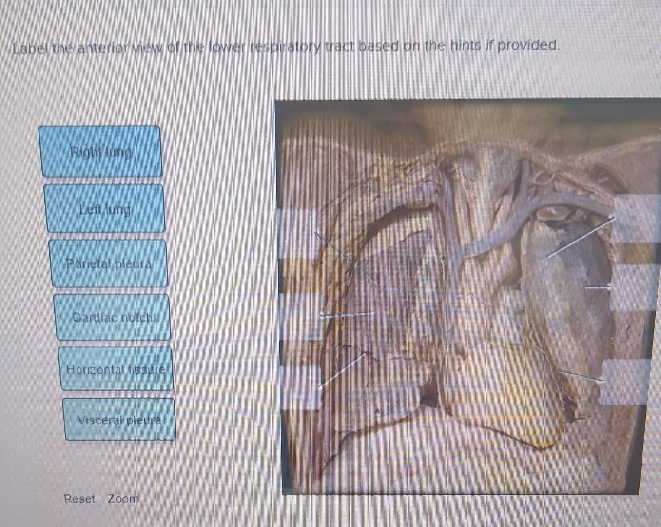 Solved Label the anterior view of the lower respiratory | Chegg.com