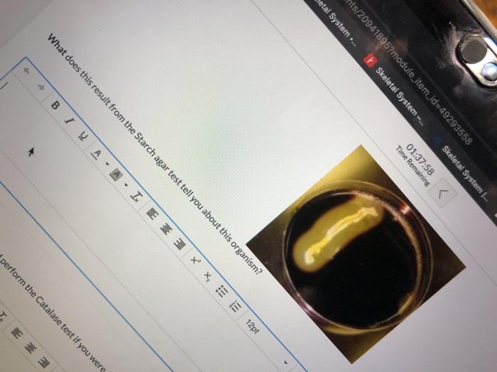 Solved what does this result from the starch agar test tell