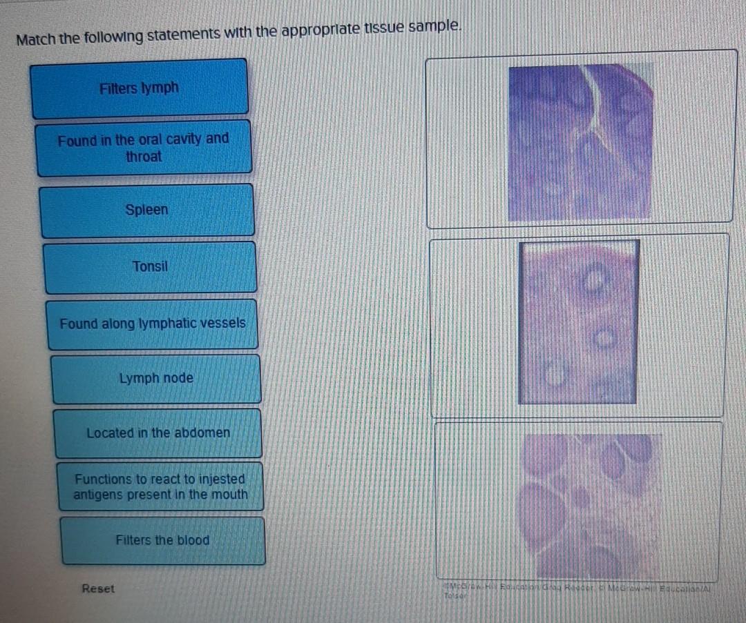 Solved Match the following statements with the appropriate