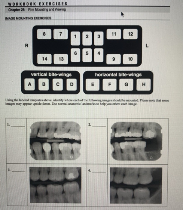 WORKBOOK EXERCISES Chapter 28 Film Mounting and