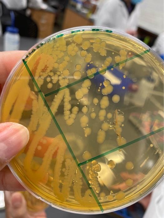 Both agar plates contain two different bacteria. | Chegg.com