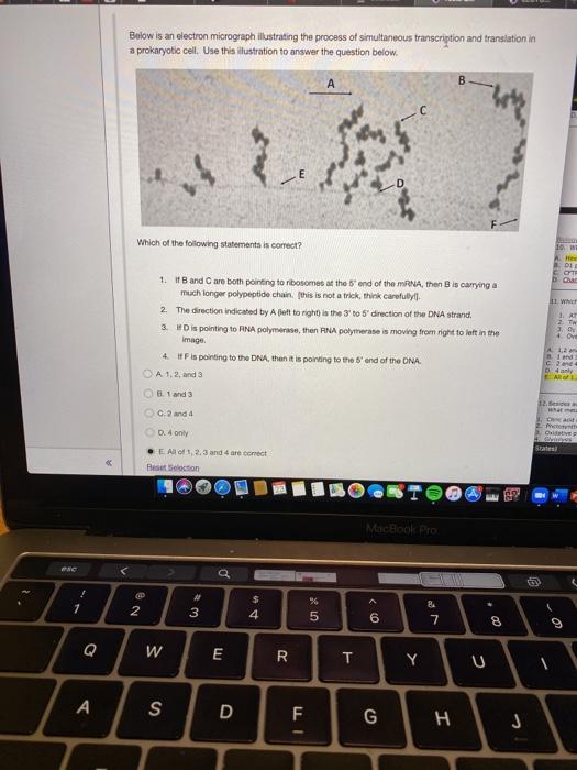 Solved Below is an electron micrograph illustrating the | Chegg.com
