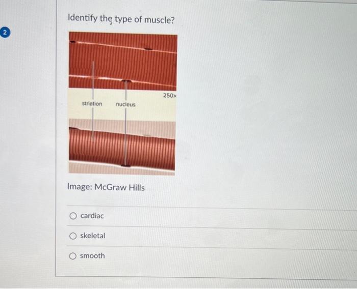 Solved 1. A stroke volume is the amount of blood ejected | Chegg.com