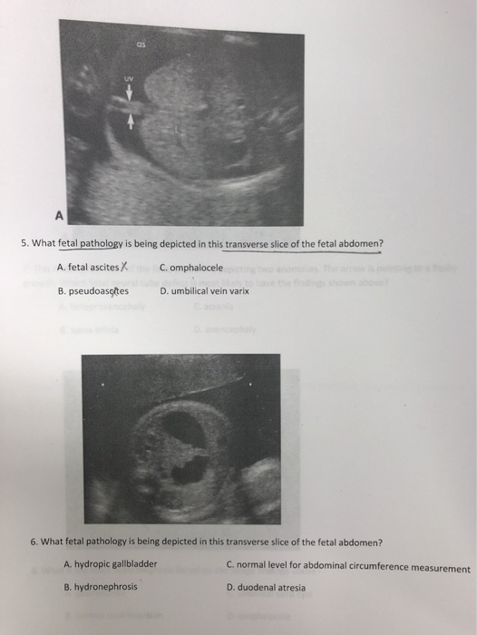 Solved UV 5. What fetal pathology is being depicted in this | Chegg.com