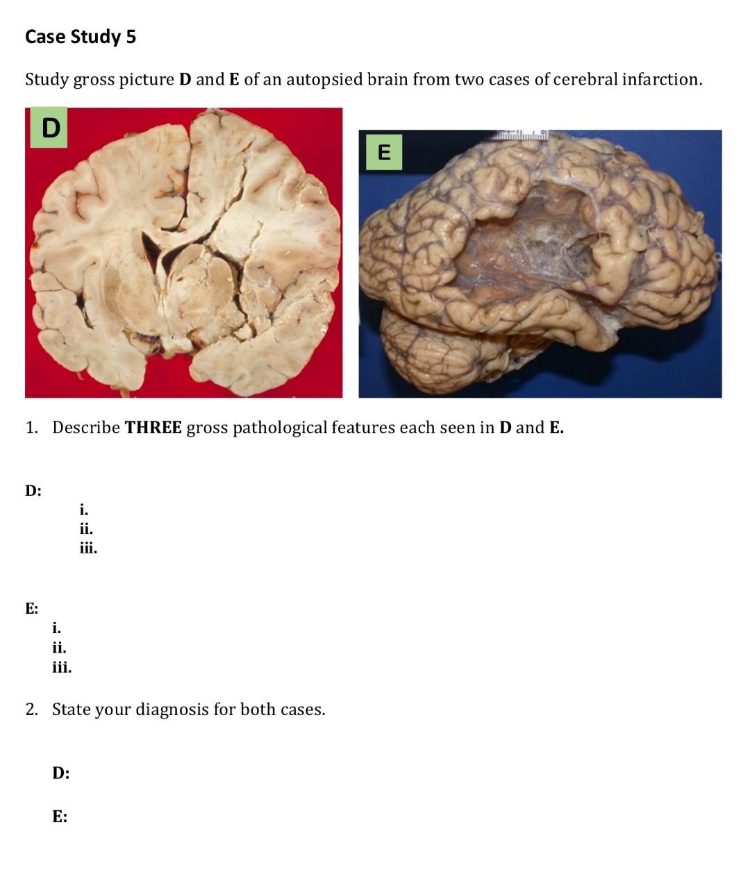 Case study 3 8 foxtrot cartoon picture