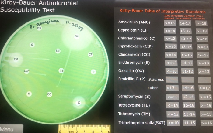 Kirby-Bauer Antimicrobial Susceptibility Test 