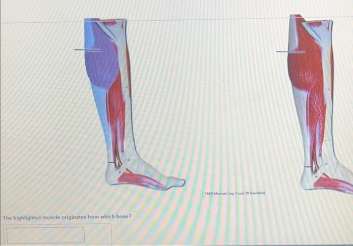 The highlighted muscle originates from which bone?
LT-M21 Munro. 20 S