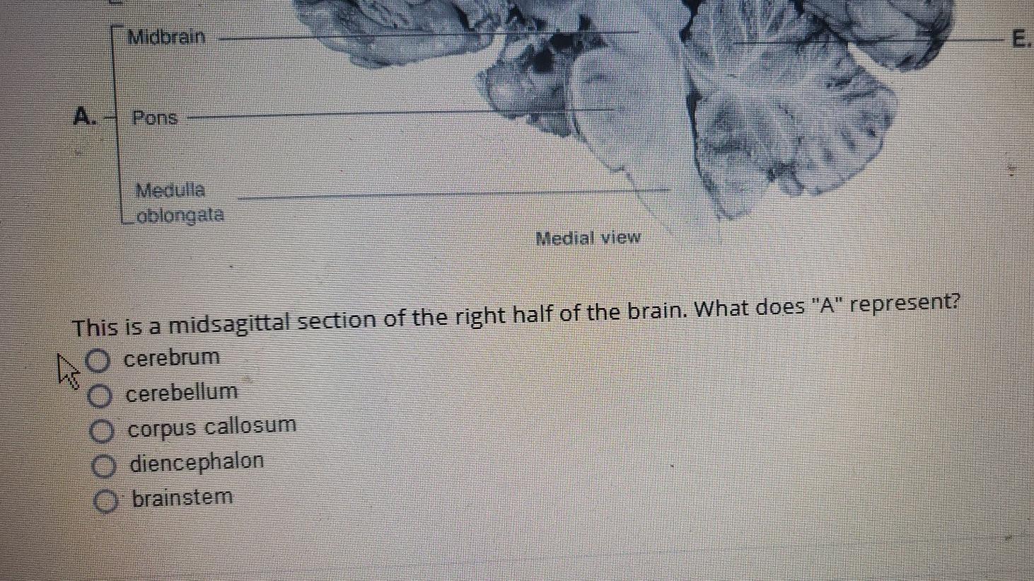 Solved ON 187 C. Anterior Thalamus Hypothalamus Posterior n. | Chegg.com