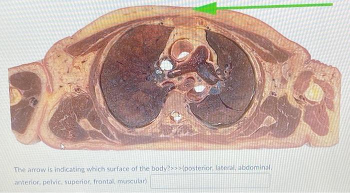 The arrow is indicating which surface of the body?>>>(posterior, lateral, abdominal anterior, pelvic, superior frontal, muscu