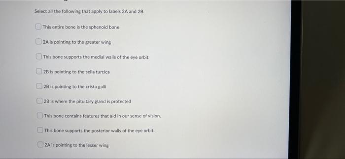 Solved Question 18 (2 points) Answer the following question | Chegg.com