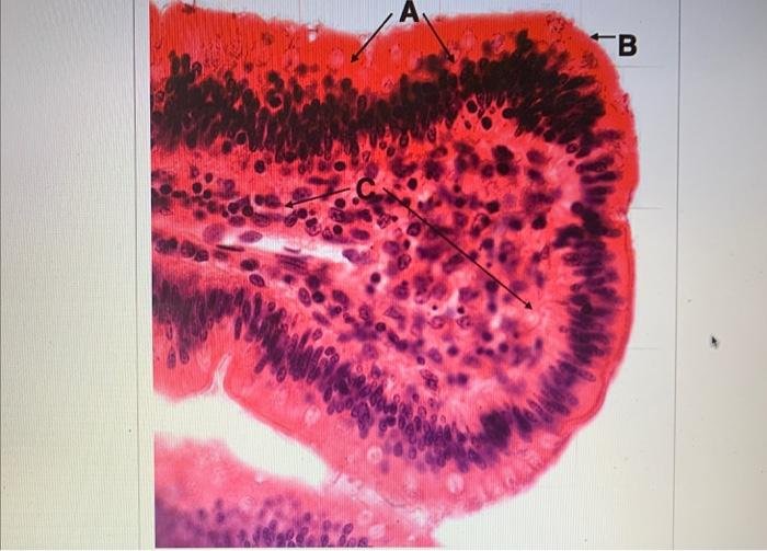 Solved А ТВ A (type of cell) B (structure on apical | Chegg.com