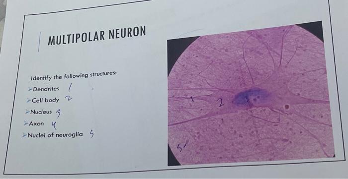 Solved MULTIPOLAR NEURON Identify the following structures: | Chegg.com