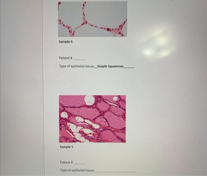solved-epithelial-tissue-biopsies-mix-up-homework-3-ives-chegg-com