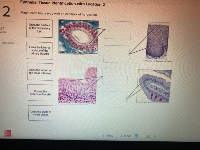 Solved Epithelial Tissue Identification with Location 2 2 | Chegg.com