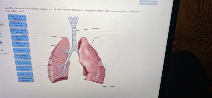 Solved tool the features of the lower respiratory tract | Chegg.com