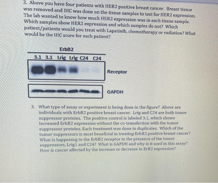 2. Above you have four patients with HER2 positive breast cancer. Breast tissue was removed and IHC was done on the tissue sa