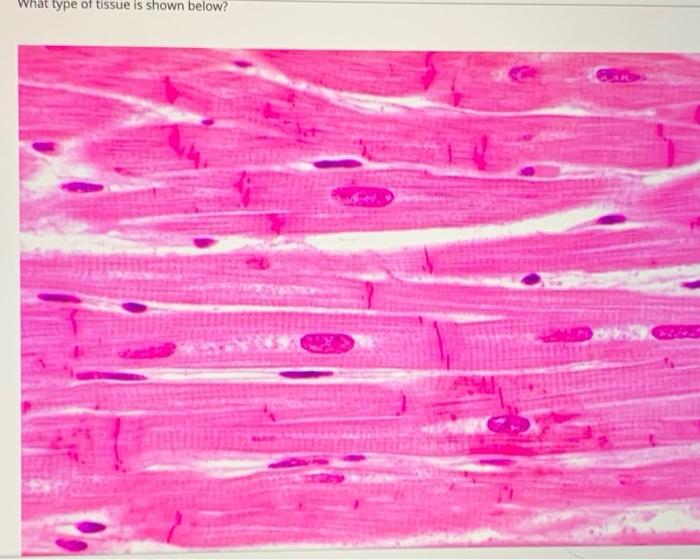 Solved What Type Of Tissue Is Shown Below?a Epithelialb | Chegg.com