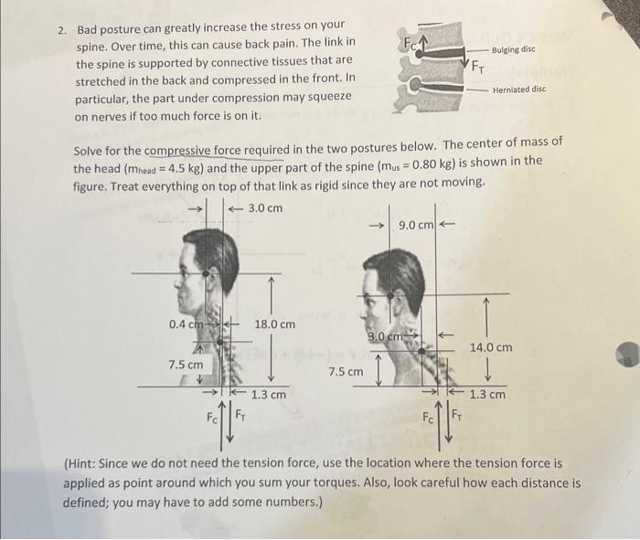Solved 2. Bad posture can greatly increase the stress on | Chegg.com