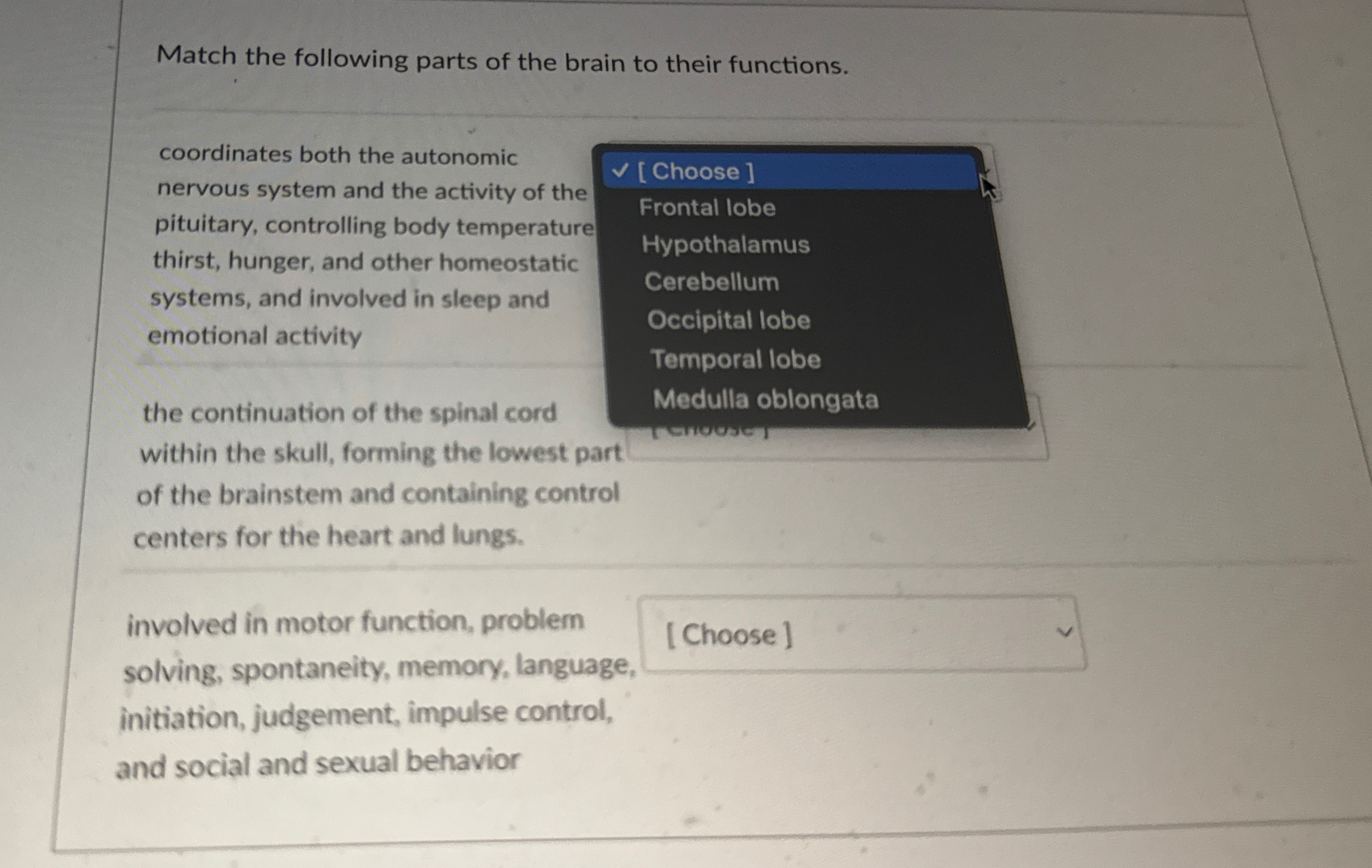Solved Match the following parts of the brain to their