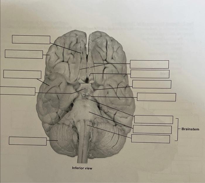 Solved Brainstem Inferior view Midbrain | Chegg.com