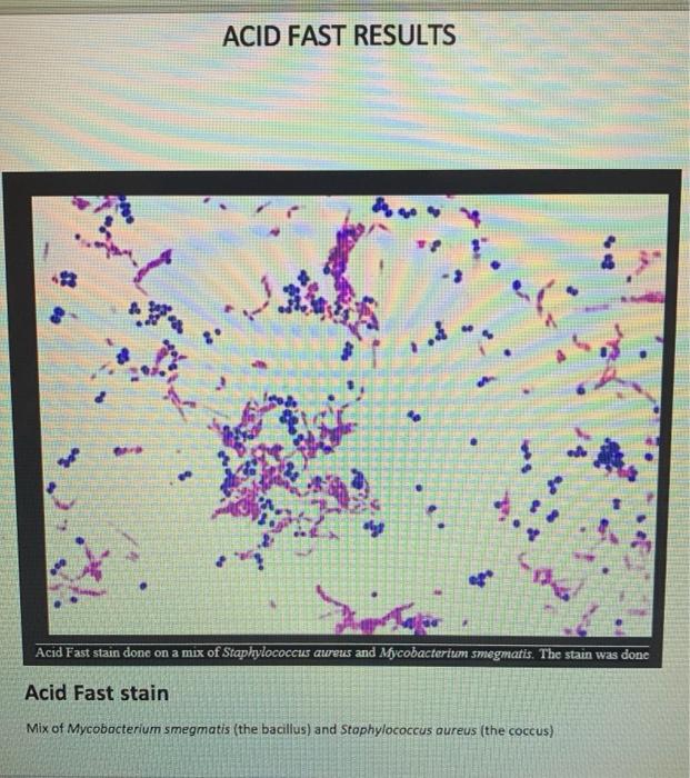 staphylococcus aureus acid fast stain
