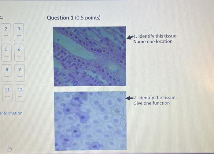 Solved Question 1 ( 0.5 Points) 1. Identify This Tissue. | Chegg.com