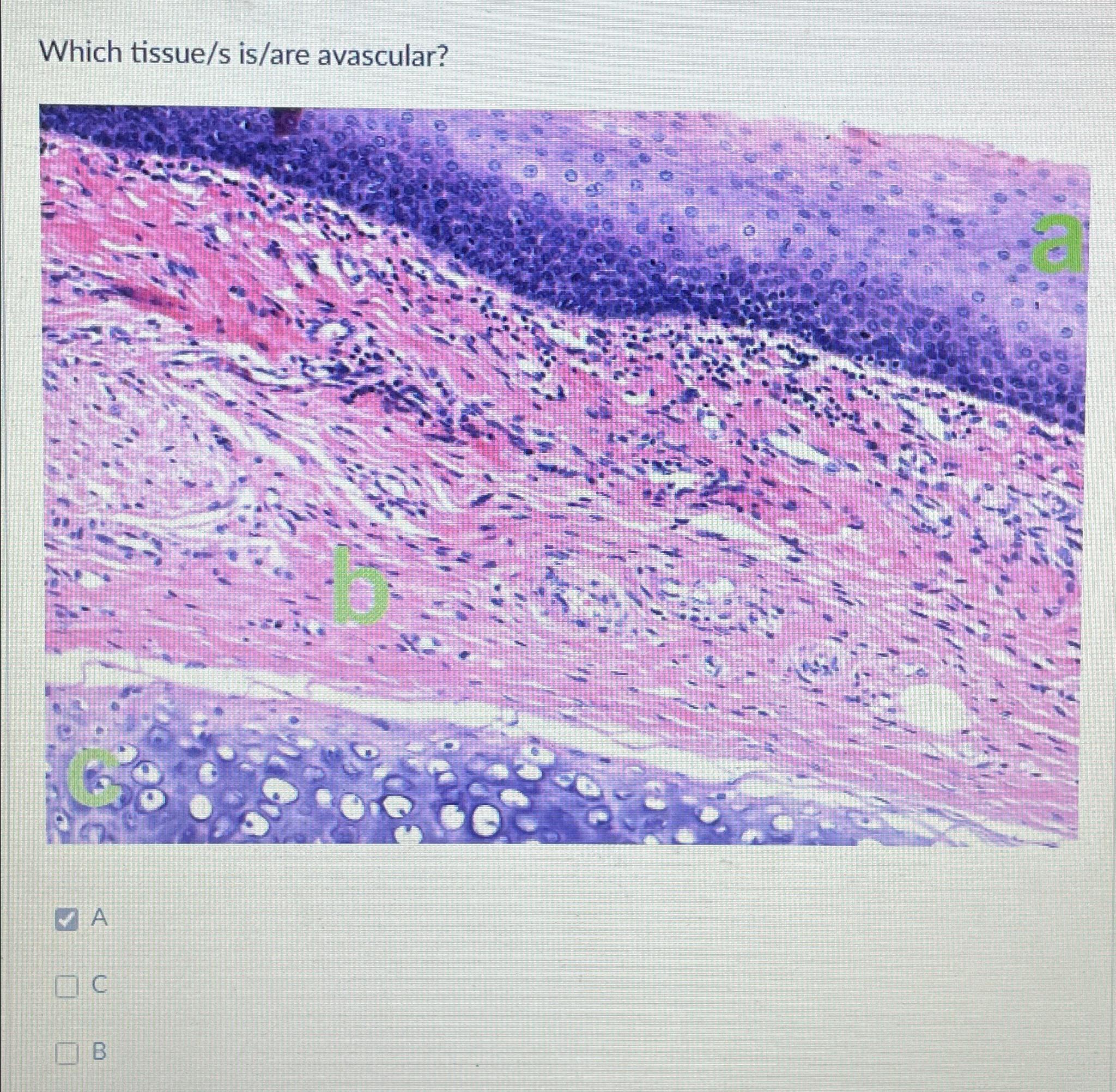 Solved Which tissue/s is/are avascular?ACB