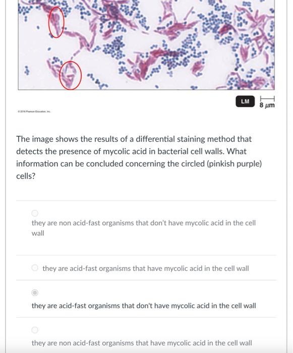 The image shows the results of a differential staining method that detects the presence of mycolic acid in bacterial cell wal