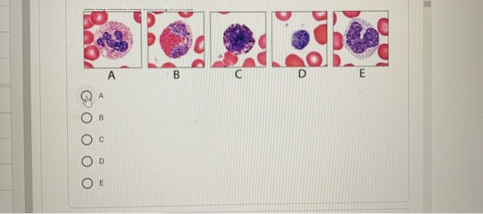 Solved A B с D E E 1 point Which labeled structure shown | Chegg.com