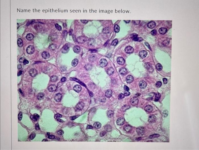 Solved Name the epithelium seen in the image | Chegg.com