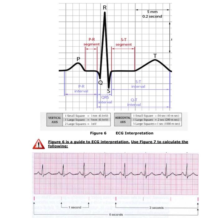 Solved Fiqure 6 is a guide to ECG interpretation. Use Fiqure | Chegg.com