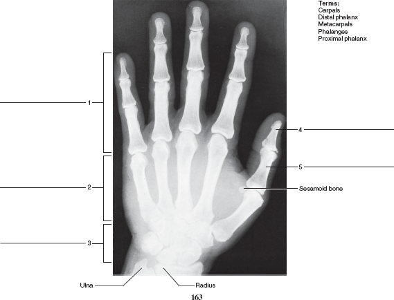 Solved: Identify the bones and features indicated in the radiograp ...