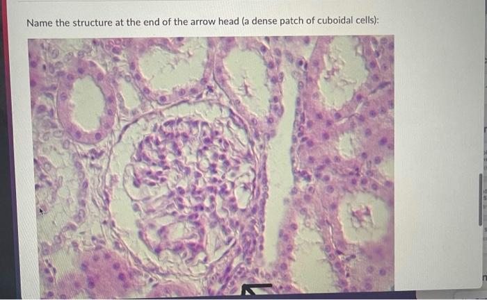 Solved Question 3 (2.5 points) Name this epithelium: SI | Chegg.com