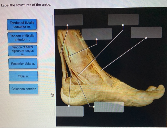 Solved Label the structures of the ankle. Tendon of tibialis | Chegg.com