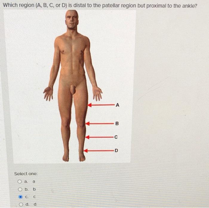 Solved Which body region is the arrow pointing to? Select