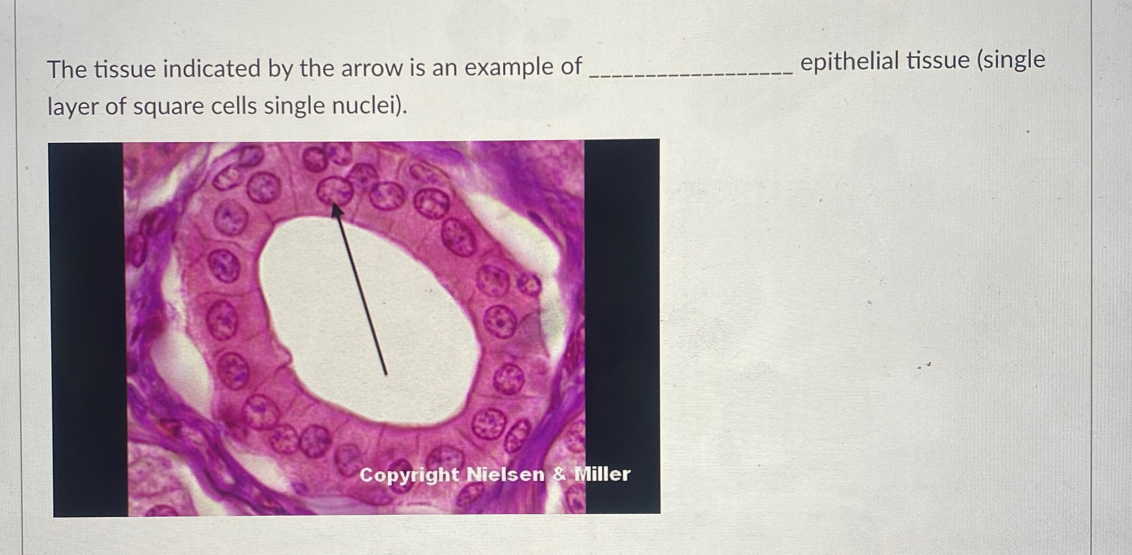 Solved The tissue indicated by the arrow is an example of. | Chegg.com