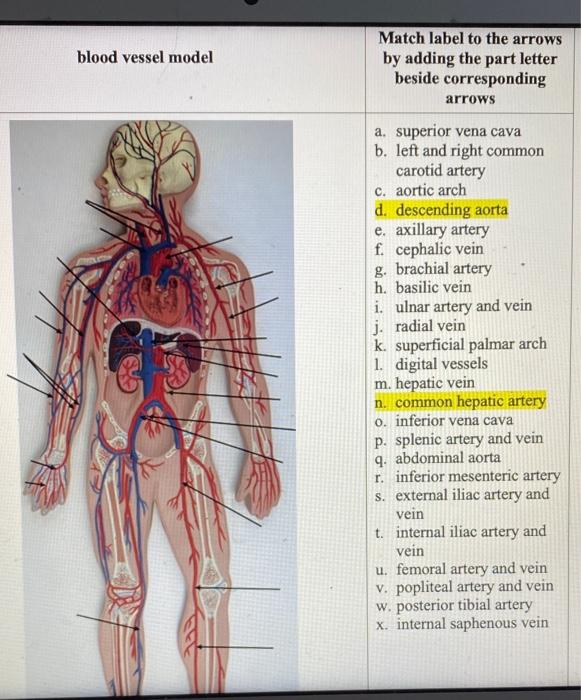 internal carotid artery model