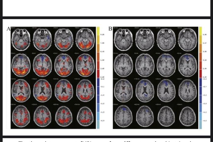 Solved The above data represents fMRI scans of two different | Chegg.com